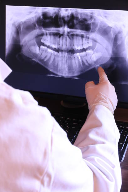 Best Emergency Tooth Extraction in Thompson Falls, MT
