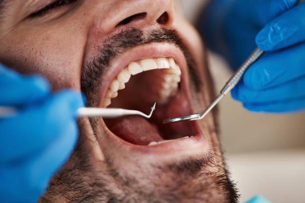 Best Emergency Broken Tooth Repair in Thompson Falls, MT